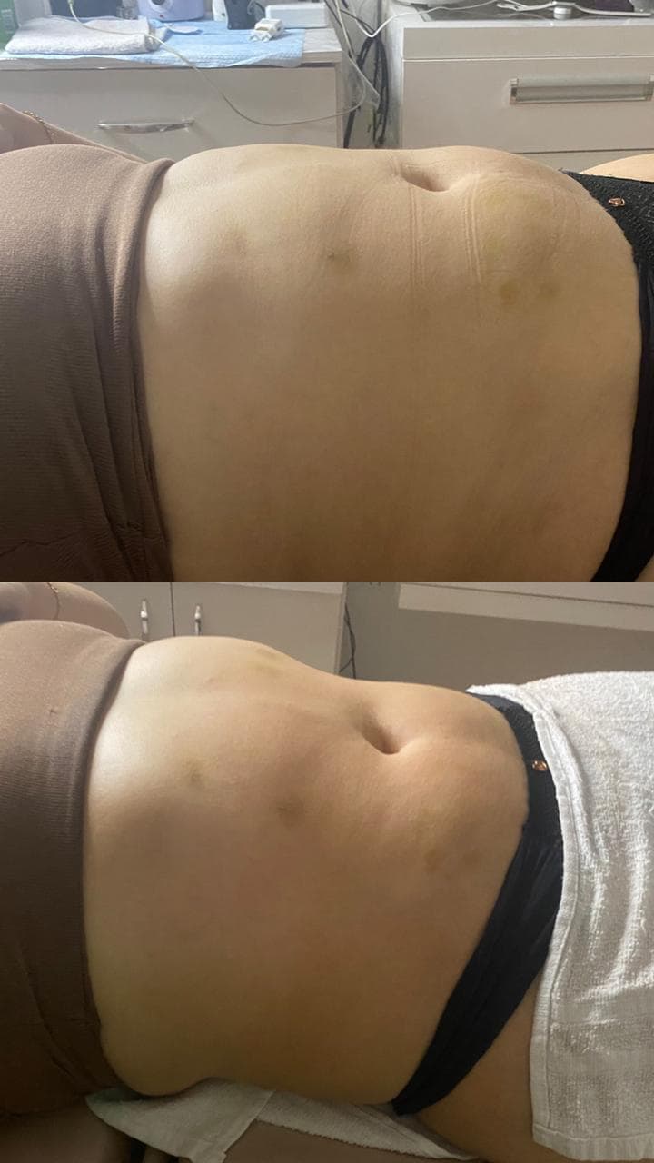 Limpeza de pele drenagem linfática e massagem modeladora